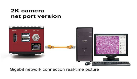 HDMI 60FPS Microscope Digital Camera With Gigabit Network Interface
